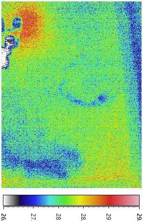 C. 紅外線探測圖像顯示有兩處明顯藍色低溫部位